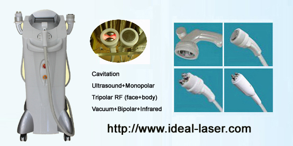 MT-616-www.ideal-laser.com