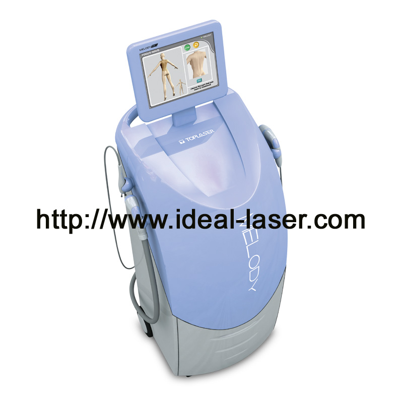 RF-D-www.ideal-laser.com-1