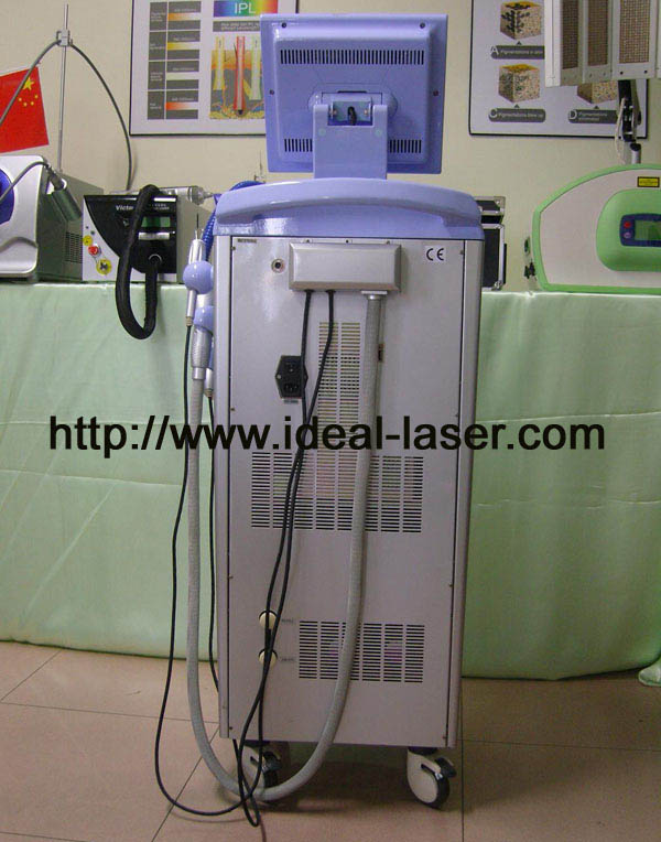 RF-D-www.ideal-laser.com-4
